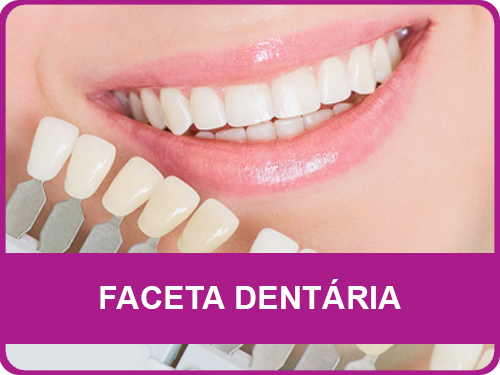 Faceta Dentária